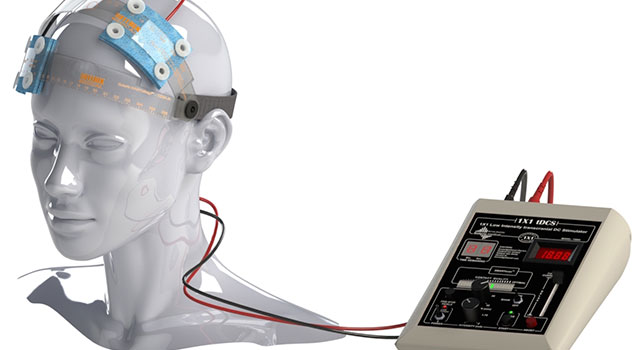 TDCS COM USO DE ELETRODOS